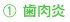1歯肉炎