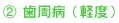 2歯周病(軽度)